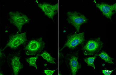 Anti-Wnt4 antibody [HL1889] used in Immunocytochemistry/ Immunofluorescence (ICC/IF). GTX637638