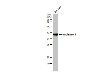 Anti-Arginase 1 antibody [HL1891] used in Western Blot (WB). GTX637640