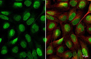 Anti-YAP1 antibody [HL1894] used in Immunocytochemistry/ Immunofluorescence (ICC/IF). GTX637643