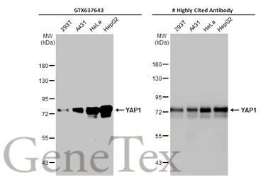 Anti-YAP1 antibody [HL1894] used in Western Blot (WB). GTX637643