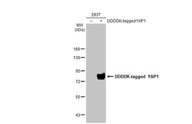 Anti-YAP1 antibody [HL1894] used in Western Blot (WB). GTX637643