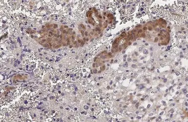 Anti-YAP1 antibody [HL1894] used in IHC (Paraffin sections) (IHC-P). GTX637643