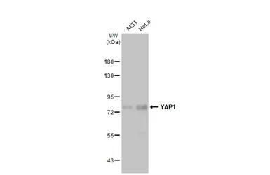 Anti-YAP1 antibody [HL1894] used in Western Blot (WB). GTX637643