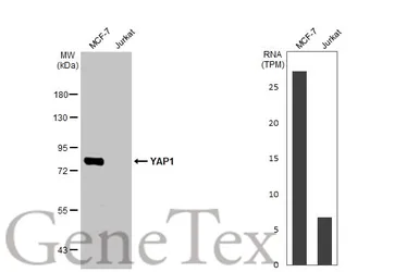 Anti-YAP1 antibody [HL1894] used in Western Blot (WB). GTX637643