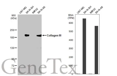 Anti-Collagen III antibody [HL1906] used in Western Blot (WB). GTX637655