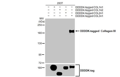 Anti-Collagen III antibody [HL1908] used in Western Blot (WB). GTX637657