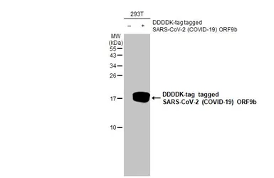 Anti-SARS-CoV-2 (COVID-19) ORF9b antibody [HL1917] used in Western Blot (WB). GTX637666