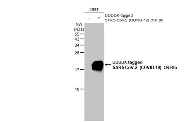 Anti-SARS-CoV-2 (COVID-19) ORF9b antibody [HL1918] used in Western Blot (WB). GTX637667