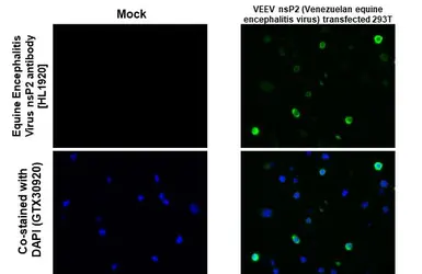 Anti-Equine Encephalitis Virus nsP2 antibody [HL1920] used in IHC-P (cell pellet) (IHC-P (cell pellet)). GTX637669