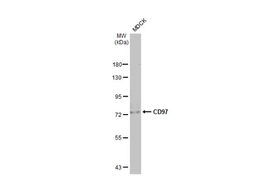 Anti-CD97 antibody [HL1924] used in Western Blot (WB). GTX637673