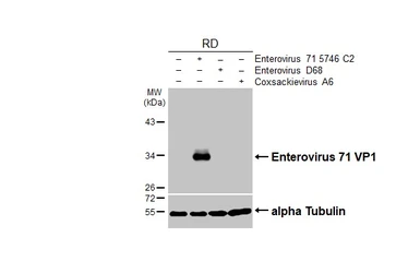 Anti-Enterovirus 71 VP1 antibody [HL1928] used in Western Blot (WB). GTX637687