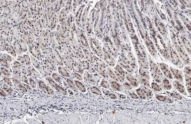 Anti-HMGA2 antibody [HL1936] used in IHC (Paraffin sections) (IHC-P). GTX637773