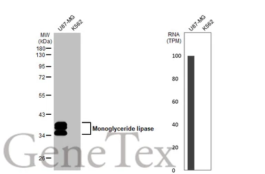 Anti-Monoglyceride lipase antibody [HL1937] used in Western Blot (WB). GTX637774