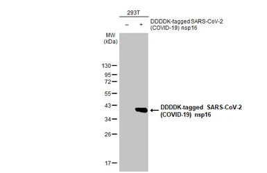 Anti-SARS-CoV-2 (COVID-19) nsp16 antibody [HL1945] used in Western Blot (WB). GTX637782