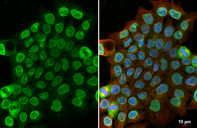 Anti-SUN1 antibody [HL1946] used in Immunocytochemistry/ Immunofluorescence (ICC/IF). GTX637783