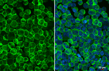 Anti-CD32B antibody [HL1948] used in Immunocytochemistry/ Immunofluorescence (ICC/IF). GTX637785