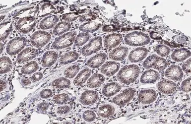 Anti-CD32B antibody [HL1948] used in IHC (Paraffin sections) (IHC-P). GTX637785