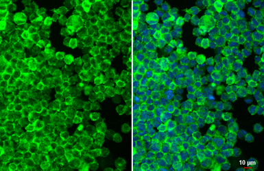 Anti-CD32B antibody [HL1948] used in Immunocytochemistry/ Immunofluorescence (ICC/IF). GTX637785