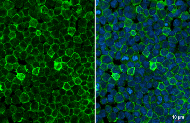 Anti-CD32B antibody [HL1950] used in Immunocytochemistry/ Immunofluorescence (ICC/IF). GTX637787