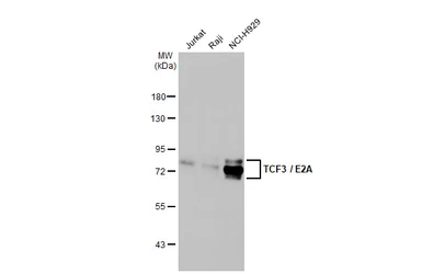 Anti-TCF3 / E2A antibody [HL1954] used in Western Blot (WB). GTX637791