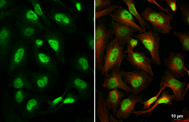 Anti-TCF3 / E2A antibody [HL1954] used in Immunocytochemistry/ Immunofluorescence (ICC/IF). GTX637791