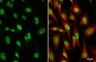 Anti-TCF3 / E2A antibody [HL1955] used in Immunocytochemistry/ Immunofluorescence (ICC/IF). GTX637792