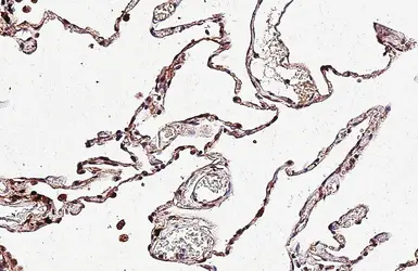 Anti-IGF1R beta antibody [HL1958] used in IHC (Paraffin sections) (IHC-P). GTX637795