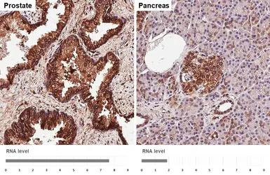 Anti-IGF1R beta antibody [HL1958] used in IHC (Paraffin sections) (IHC-P). GTX637795