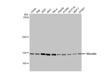 Anti-Vinculin antibody [HL1964] used in Western Blot (WB). GTX637857