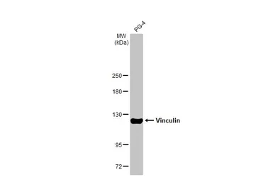 Anti-Vinculin antibody [HL1964] used in Western Blot (WB). GTX637857