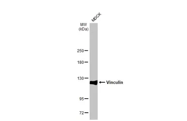Anti-Vinculin antibody [HL1964] used in Western Blot (WB). GTX637857