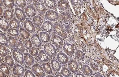 Anti-Vinculin antibody [HL1964] used in IHC (Paraffin sections) (IHC-P). GTX637857