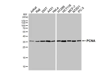 Anti-PCNA antibody [HL1965] used in Western Blot (WB). GTX637858