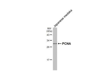 Anti-PCNA antibody [HL1965] used in Western Blot (WB). GTX637858