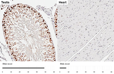 Anti-PCNA antibody [HL1965] used in IHC (Paraffin sections) (IHC-P). GTX637858