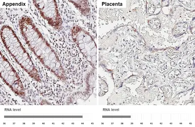 Anti-PCNA antibody [HL1965] used in IHC (Paraffin sections) (IHC-P). GTX637858