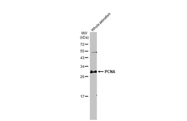 Anti-PCNA antibody [HL1965] used in Western Blot (WB). GTX637858
