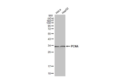 Anti-PCNA antibody [HL1966] used in Western Blot (WB). GTX637859