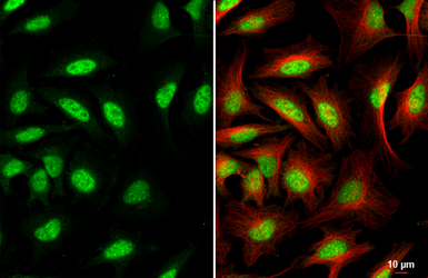 Anti-PCNA antibody [HL1966] used in Immunocytochemistry/ Immunofluorescence (ICC/IF). GTX637859