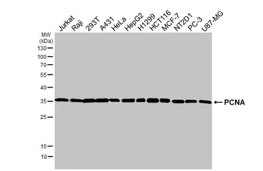 Anti-PCNA antibody [HL1966] used in Western Blot (WB). GTX637859