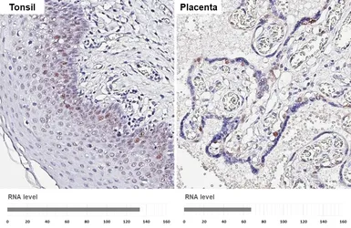 Anti-PCNA antibody [HL1966] used in IHC (Paraffin sections) (IHC-P). GTX637859
