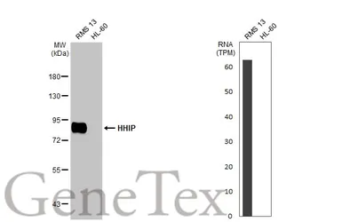 Anti-HHIP antibody [HL1969] used in Western Blot (WB). GTX637862
