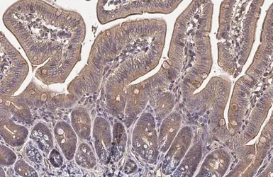 Anti-HHIP antibody [HL1969] used in IHC (Paraffin sections) (IHC-P). GTX637862