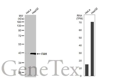 Anti-FAH antibody [HL1970] used in Western Blot (WB). GTX637863