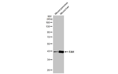 Anti-FAH antibody [HL1970] used in Western Blot (WB). GTX637863