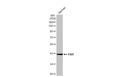 Anti-FAH antibody [HL1970] used in Western Blot (WB). GTX637863