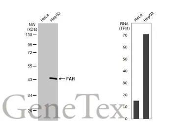 Anti-FAH antibody [HL1972] used in Western Blot (WB). GTX637865