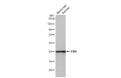 Anti-FAH antibody [HL1972] used in Western Blot (WB). GTX637865
