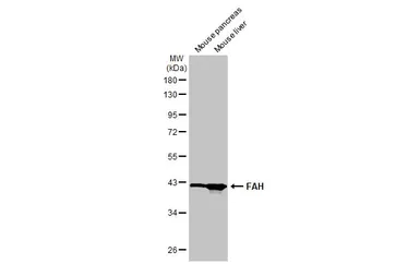 Anti-FAH antibody [HL1972] used in Western Blot (WB). GTX637865