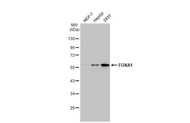 Anti-FOXA1 antibody [HL1975] used in Western Blot (WB). GTX637868